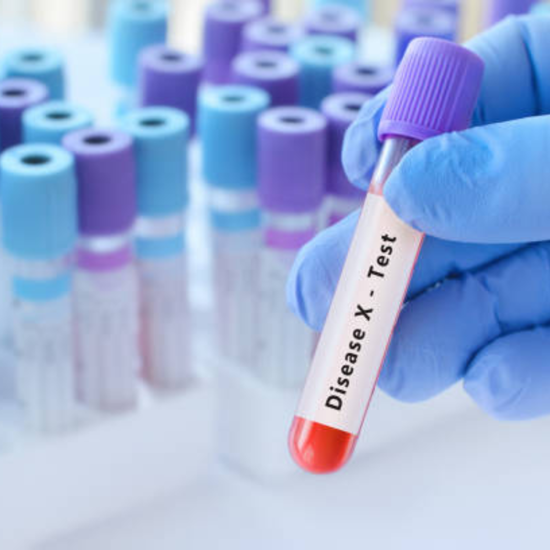 Image illustrates COVID-19 Disease X.